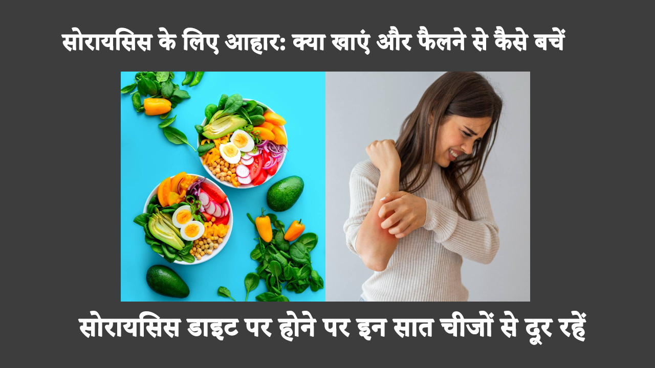 सोरायसिस के लिए आहार: क्या खाएं और फैलने से कैसे बचें